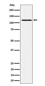 Western blot testing of lysate from human Ramos cells treated with pervanadate, using Phospho-JAK1 (Tyr1034/1035) antibody. Phospho-JAK1 (Tyr1034/1035) detected in pervanadate-treated Ramos lysate as a single band at ~125â130 kDa, consistent with activated full-length JAK1.