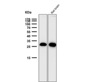 Western blot testing of mouse and rat samples using the PDGFB antibody at 1:3000 dilution for 1 hour at room temperature. Predicted molecular weight ~27 kDa. Light dimer banding may be observed at 40-50 kDa and multimers at 90-100 kDa.
