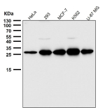 Western blot testing of human samples using the PDGFB antibody at 1:3000 dilution for 1 hour at room temperature. Predicted molecular weight ~27 kDa. Light dimer banding may be observed at 40-50 kDa and multimers at 90-100 kDa.