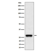 Western blot analysis of PDGF B expression in human A375 cell lysate using PDGFB antibody. Predicted molecular weight ~27 kDa. Light dimer banding may be observed at 40-50 kDa and multimers at 90-100 kDa.