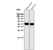 Western blot testing of mouse and rat samples using the SEC14L2 antibody at 1:5000 dilution for 1 hour at room temperature. SEC14L2 antibody detects a single band at ~40-43 kDa in mouse and rat liver. Although the predicted size is ~46 kDa, SEC14L2 typically migrates slightly faster on SDS-PAGE due to sequence composition and minor terminal processing.