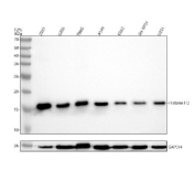 Western blot analysis of Histone H3 (acetyl K9) using anti-Histone H3 (acetyl K9) antibody. Electrophoresis was performed on a 12% SDS-PAGE gel at 80V (Stacking gel) / 120V (Resolving gel) for 2 hours. Lane 1: human 293T whole cell lysates, Lane 2: human U20S whole cell lysates, Lane 3: human T98G whole cell lysates, Lane 4: human whole cell lysates, Lane 5: human K562 whole cell lysates, Lane 6: human SH-SY5Y whole cell lysates, Lane 7: human U251 whole cell lysates. After electrophoresis, proteins were transferred to a nitrocellulose membrane at 150 mA for 50-90 minutes. Blocked the membrane with 5% non-fat milk/TBS for 1.5 hour at RT. The membrane was incubated with rabbit anti-Histone H3 (acetyl K9) antibody at 1:500 overnight at 4oC, then washed with TBS-0.1%Tween 3 times with 5 minutes each and probed with a goat anti-rabbit IgG-HRP secondary antibody at a dilution of 1:5000 for 1.5 hour at RT. The signal was developed using an ECL Plus Western Blotting Substrate. A specific band was detected for Histone H3 (acetyl K9) at approximately 15 kDa. The expected molecular weight of Histone H3 (acetyl K9) is at 15 kDa.
