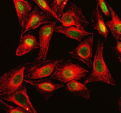 Immunofluorescent staining of DKC1 using anti-DKC1 antibody (green) and anti-Beta Tubulin antibody (red). DKC1 was detected in an immunocytochemical section of human U2OS cells. Enzyme antigen retrieval was performed using IHC enzyme antigen retrieval reagent for 15 mins. The cells were blocked with 10% goat serum. And then incubated with 5 ug/ml rabbit anti-DKC1 antibody and mouse anti-Beta Tubulin antibody overnight at 4oC. DyLight 488 Conjugated Goat Anti-Rabbit IgG and DyLight?594 Conjugated Goat Anti-Mouse IgG were used as secondary antibody at 1:500 dilution and incubated for 30 minutes at 37oC. Visualize using a fluorescence microscope and filter sets appropriate for the label used.