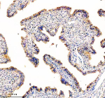 Immunohistochemical staining of TCTN1 using anti-TCTN1 antibody. TCTN1 was detected in a paraffin-embedded section of human fallopian tube tissue. Heat mediated antigen retrieval was performed in EDTA buffer (pH 8.0, epitope retrieval solution). The tissue section was blocked with 10% goat serum. The tissue section was then incubated with 2 ug/ml rabbit anti-TCTN1 antibody overnight at 4oC. Peroxidase Conjugated Goat Anti-rabbit IgG was used as secondary antibody and incubated for 30 minutes at 37oC. The tissue section was developed using an HRP secondary and DAB substrate.
