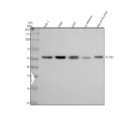 Western blot analysis of TCTN1 using anti-TCTN1 antibody. Electrophoresis was performed on a 10% SDS-PAGE gel at 80V (Stacking gel) / 120V (Resolving gel) for 2 hours. Lane 1: human THP-1 whole cell lysates, Lane 2: human SIHA whole cell lysates, Lane 3: human U251 whole cell lysates, Lane 4: rat thymus tissue lysates, Lane 5: mouse thymus tissue lysates. After electrophoresis, proteins were transferred to a nitrocellulose membrane at 150 mA for 50-90 minutes. Blocked the membrane with 5% non-fat milk/TBS for 1.5 hour at RT. The membrane was incubated with rabbit anti-TCTN1 antibody at 0.5 ug/ml overnight at 4oC, then washed with TBS-0.1%Tween 3 times with 5 minutes each and probed with a goat anti-rabbit IgG-HRP secondary antibody at a dilution of 1:5000 for 1.5 hour at RT. The signal was developed using an ECL Plus Western Blotting Substrate. Western blot detection of TCTN1 shows a doublet at ~55 kDa across the tested lysates. The observed size is within the reported 55-64 kDa range for TCTN1 and likely reflects isoform- or modification-dependent migration.