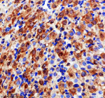 Immunohistochemical staining of EVC2 using anti-EVC2 antibody. EVC2 was detected in a paraffin-embedded section of rat ovary tissue. Heat mediated antigen retrieval was performed in EDTA buffer (pH 8.0, epitope retrieval solution). The tissue section was blocked with 10% goat serum. The tissue section was then incubated with 2 ug/ml rabbit anti-EVC2 antibody overnight at 4oC. Peroxidase Conjugated Goat Anti-rabbit IgG was used as secondary antibody and incubated for 30 minutes at 37oC. The tissue section was developed using an HRP secondary and DAB substrate.