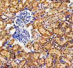 Immunohistochemical staining of EVC2 using anti-EVC2 antibody. EVC2 was detected in a paraffin-embedded section of rat kidney tissue. Heat mediated antigen retrieval was performed in EDTA buffer (pH 8.0, epitope retrieval solution). The tissue section was blocked with 10% goat serum. The tissue section was then incubated with 2 ug/ml rabbit anti-EVC2 antibody overnight at 4oC. Peroxidase Conjugated Goat Anti-rabbit IgG was used as secondary antibody and incubated for 30 minutes at 37oC. The tissue section was developed using an HRP secondary and DAB substrate.