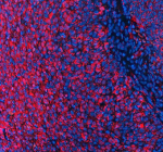 Immunofluorescent staining of EVC2 using anti-EVC2 antibody (red). EVC2 was detected in a paraffin-embedded section of rat ovary tissue. Heat mediated antigen retrieval was performed in EDTA buffer (pH 8.0, epitope retrieval solution). The tissue section was blocked with 10% goat serum. The tissue section was then incubated with 5 ug/ml rabbit anti-EVC2 antibody overnight at 4oC. Cy3 Conjugated Goat Anti-Rabbit IgG was used as secondary antibody at 1:500 dilution and incubated for 30 minutes at 37oC. The section was counterstained with DAPI nuclear stain (blue). Visualize using a fluorescence microscope and filter sets appropriate for the label used.