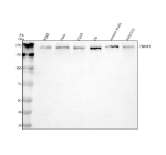 Western blot analysis of PBRM1 using anti-PBRM1 antibody. Electrophoresis was performed on a 8% SDS-PAGE gel at 80V (Stacking gel) / 120V (Resolving gel) for 2 hours. Lane 1: human K562 whole cell lysates, Lane 2: human Hela whole cell lysates, Lane 3: human U2OS whole cell lysates, Lane 4: rat C6 whole cell lysates, Lane 5: mouse brain tissue lysates, Lane 6: mouse NIH/3T3 whole cell lysates. After electrophoresis, proteins were transferred to a nitrocellulose membrane at 150 mA for 50-90 minutes. Blocked the membrane with 5% non-fat milk/TBS for 1.5 hour at RT. The membrane was incubated with rabbit anti-PBRM1 antibody at 0.5 ug/ml overnight at 4oC, then washed with TBS-0.1%Tween 3 times with 5 minutes each and probed with a goat anti-rabbit IgG-HRP secondary antibody at a dilution of 1:5000 for 1.5 hour at RT. The signal was developed using an ECL Plus Western Blotting Substrate. Western blot detection of PBRM1 shows a single band migrating at ~240 kDa. Despite a calculated mass of ~193 kDa, PBRM1 commonly exhibits reduced electrophoretic mobility on SDS-PAGE, consistent with chromatin remodeler subunits and post-translationally modified forms.
