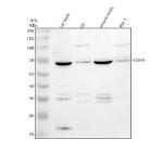 Western blot analysis of TGM4 using anti-TGM4 antibody. Electrophoresis was performed on a 10% SDS-PAGE gel at 80V (Stacking gel) / 120V (Resolving gel) for 2 hours. Lane 1: rat testis tissue lysates, Lane 2: rat C6 whole cell lysates, Lane 3: mouse testis tissue lysates, Lane 4: mouse RM-1 whole cell lysates. After electrophoresis, proteins were transferred to a nitrocellulose membrane at 150 mA for 50-90 minutes. Blocked the membrane with 5% non-fat milk/TBS for 1.5 hour at RT. The membrane was incubated with rabbit anti-TGM4 antibody at 0.5 ug/ml overnight at 4oC, then washed with TBS-0.1%Tween 3 times with 5 minutes each and probed with a goat anti-rabbit IgG-HRP secondary antibody at a dilution of 1:5000 for 1.5 hour at RT. The signal was developed using an ECL Plus Western Blotting Substrate. A specific band was detected for TGM4 at approximately 68 kDa. The expected molecular weight of TGM4 is ~77 kDa.
