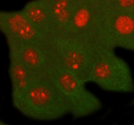 Immunofluorescent staining of RFXANK using anti-RFXANK antibody (red) and anti-Beta Tubulin antibody (green). RFXANK was detected in immunocytochemical section of cell. Enzyme antigen retrieval was performed using IHC enzyme antigen retrieval reagent for 15 mins. The cells were blocked with 10% goat serum. And then incubated with 5 ug/ml rabbit anti-RFXANK antibody and mouse anti-Beta Tubulin antibody overnight at 4oC. Cy3 Conjugated Goat Anti-Rabbit IgG and DyLight 488 Conjugated Goat Anti-Mouse IgG were used as secondary antibody at 1:500 dilution and incubated for 30 minutes at 37oC. Visualize using a fluorescence microscope and filter sets appropriate for the label used.