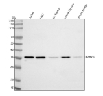 Western blot analysis of PARVG using anti-PARVG antibody. Lane 1: human Jurkat whole cell lysates, Lane 2: human HEL1 whole cell lysates, Lane 3: rat thymus tissue lysates, Lane 4: mouse thymus tissue lysates, Lane 5: mouse spleen tissue lysates. After electrophoresis, proteins were transferred to a nitrocellulose membrane at 150 mA for 50-90 minutes. Blocked the membrane with 5% non-fat milk/TBS for 1.5 hour at RT. The membrane was incubated with rabbit anti-PARVG antibody at 0.5 ug/ml overnight at 4oC, then washed with TBS-0.1%Tween 3 times with 5 minutes each and probed with a goat anti-rabbit IgG-HRP secondary antibody at a dilution of 1:5000 for 1.5 hour at RT. The signal was developed using enhanced chemiluminescent. A specific band was detected for PARVG at approximately 37 kDa. The expected molecular weight of PARVG is ~37 kDa.