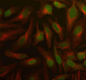 Immunofluorescent staining of PSMD5 using anti-PSMD5 antibody (green) and anti-Beta Tubulin antibody (red). PSMD5 was detected in an immunocytochemical section of Hela cells. Enzyme antigen retrieval was performed using IHC enzyme antigen retrieval reagent for 15 mins. The cells were blocked with 10% goat serum. And then incubated with 5 ug/ml rabbit anti-PSMD5 antibody and mouse anti-Beta Tubulin antibody overnight at 4oC. DyLight 488 Conjugated Goat Anti-Rabbit IgG and Cy3 Conjugated Goat Anti-Mouse IgG were used as secondary antibody at 1:500 dilution and incubated for 30 minutes at 37oC. Visualize using a fluorescence microscope and filter sets appropriate for the label used.