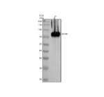 Western blot analysis of TYRP1 using anti-TYRP1 antibody. Electrophoresis was performed on a 10% SDS-PAGE gel at 80V (Stacking gel) / 120V (Resolving gel) for 2 hours. Lane 1: mouse B16 whole cell lysates. After electrophoresis, proteins were transferred to a nitrocellulose membrane at 150 mA for 50-90 minutes. Blocked the membrane with 5% non-fat milk/TBS for 1.5 hour at RT. The membrane was incubated with rabbit anti-TYRP1 antibody at 0.5 ug/ml overnight at 4oC, then washed with TBS-0.1%Tween 3 times with 5 minutes each and probed with a goat anti-rabbit IgG-HRP secondary antibody at a dilution of 1:5000 for 1.5 hour at RT. The signal was developed using an ECL Plus Western Blotting Substrate. Western blot of TYRP1 shows a predominant band at ~80 kDa, consistent with the mature N-glycosylated form of the ~61 kDa core protein commonly observed in pigmented melanoma cells.