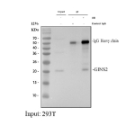 Immunoprecipitating (IP) PSF2/GINS2 in 293T whole cell lysate followed by western blot analysis of PSF2/GINS2 using anti-GINS2 antibody; Lane 1: 293T whole cell lysates (30ug); Lane 2: Rabbit control IgG instead of anti-GINS2 antibody in 293T whole cell lysate; Lane 3: anti-GINS2 antibody (2ug) + 293T whole cell lysate (500ug). After electrophoresis, proteins were transferred to a membrane. Then the membrane was incubated with rabbit anti-GINS2 antibody at a dilution of 0.5 ug/ml and probed with a goat anti-rabbit IgG-HRP secondary antibody. The signal is developed using ECL Plus Western Blotting Substrate. The expected molecular weight of PSF2/GINS2 is at 21 kDa.