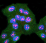 Immunofluorescent staining of SURF6 using anti-SURF6 antibody (red) and anti-Beta Tubulin antibody (green). SURF6 was detected in immunocytochemical section of U2OS cell. Enzyme antigen retrieval was performed using IHC enzyme antigen retrieval reagent for 15 mins. The cells were blocked with 10% goat serum. And then incubated with 5 ug/ml rabbit anti-SURF6 antibody and mouse anti-Beta Tubulin antibody overnight at 4oC. Cy3 Conjugated Goat Anti-Rabbit IgG and FITC Conjugated Goat Anti-Mouse IgG were used as secondary antibody at 1:500 dilution and incubated for 30 minutes at 37oC. The section was counterstained with DAPI nuclear stain (blue). Visualize using a fluorescence microscope and filter sets appropriate for the label used.