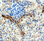 Immunohistochemical staining of SRA1 using anti-SRA1 antibody. SRA1 was detected in a paraffin-embedded section of rat kidney tissue. Heat mediated antigen retrieval was performed in EDTA buffer (pH 8.0, epitope retrieval solution). The tissue section was blocked with 10% goat serum. The tissue section was then incubated with 1: 200 rabbit anti-SRA1 antibody overnight at 4oC. Peroxidase Conjugated Goat Anti-rabbit IgG was used as secondary antibody and incubated for 30 minutes at 37oC. The tissue section was developed using an HRP secondary and DAB substrate.