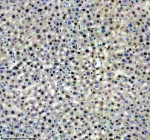 Immunohistochemical staining of SRA1 using anti-SRA1 antibody. SRA1 was detected in a paraffin-embedded section of mouse liver tissue. Heat mediated antigen retrieval was performed in EDTA buffer (pH 8.0, epitope retrieval solution). The tissue section was blocked with 10% goat serum. The tissue section was then incubated with 1: 200 rabbit anti-SRA1 antibody overnight at 4oC. Peroxidase Conjugated Goat Anti-rabbit IgG was used as secondary antibody and incubated for 30 minutes at 37oC. The tissue section was developed using an HRP secondary and DAB substrate.