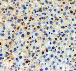 Immunohistochemical staining of SRA1 using anti-SRA1 antibody. SRA1 was detected in a paraffin-embedded section of rat liver tissue. Heat mediated antigen retrieval was performed in EDTA buffer (pH 8.0, epitope retrieval solution). The tissue section was blocked with 10% goat serum. The tissue section was then incubated with 1: 200 rabbit anti-SRA1 antibody overnight at 4oC. Peroxidase Conjugated Goat Anti-rabbit IgG was used as secondary antibody and incubated for 30 minutes at 37oC. The tissue section was developed using an HRP secondary and DAB substrate.