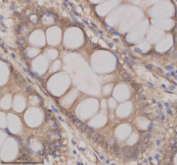 Immunohistochemical staining of OAZ1 using anti-OAZ1 antibody. OAZ1 was detected in a paraffin-embedded section of human colon tissue. Heat mediated antigen retrieval was performed in EDTA buffer (pH 8.0, epitope retrieval solution). The tissue section was blocked with 10% goat serum. The tissue section was then incubated with 2 ug/ml rabbit anti-OAZ1 antibody overnight at 4oC. Peroxidase Conjugated Goat Anti-rabbit IgG was used as secondary antibody and incubated for 30 minutes at 37oC. The tissue section was developed using an HRP secondary and DAB substrate.