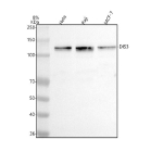 Western blot analysis of DIS3 using anti-DIS3 antibody. Lane 1: human Hela whole cell lysates, Lane 2: human Raji whole cell lysates, Lane 3: human MCF-7 whole cell lysates. After electrophoresis, proteins were transferred to a nitrocellulose membrane at 150 mA for 50-90 minutes. Blocked the membrane with 5% non-fat milk/TBS for 1.5 hour at RT. The membrane was incubated with rabbit anti-DIS3 antibody at 0.5 ug/ml overnight at 4oC, then washed with TBS-0.1%Tween 3 times with 5 minutes each and probed with a goat anti-rabbit IgG-HRP secondary antibody at a dilution of 1:5000 for 1.5 hour at RT. The signal was developed using enhanced chemiluminescent. A specific band was detected for DIS3 at approximately 109 kDa. The expected molecular weight of DIS3 is ~109 kDa.