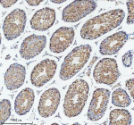 Immunohistochemical staining of DIS3 using anti-DIS3 antibody. DIS3 was detected in a paraffin-embedded section of mouse testis tissue. Heat mediated antigen retrieval was performed in EDTA buffer (pH 8.0, epitope retrieval solution). The tissue section was blocked with 10% goat serum. The tissue section was then incubated with 2 ug/ml rabbit anti-DIS3 antibody overnight at 4oC. Peroxidase Conjugated Goat Anti-rabbit IgG was used as secondary antibody and incubated for 30 minutes at 37oC. The tissue section was developed using an HRP secondary and DAB substrate.