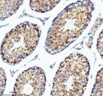 Immunohistochemical staining of DIS3 using anti-DIS3 antibody. DIS3 was detected in a paraffin-embedded section of mouse testis tissue. Heat mediated antigen retrieval was performed in EDTA buffer (pH 8.0, epitope retrieval solution). The tissue section was blocked with 10% goat serum. The tissue section was then incubated with 2 ug/ml rabbit anti-DIS3 antibody overnight at 4oC. Peroxidase Conjugated Goat Anti-rabbit IgG was used as secondary antibody and incubated for 30 minutes at 37oC. The tissue section was developed using an HRP secondary and DAB substrate.