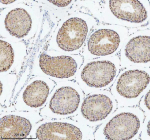 Immunohistochemical staining of DIS3 using anti-DIS3 antibody. DIS3 was detected in a paraffin-embedded section of rat testis tissue. Heat mediated antigen retrieval was performed in EDTA buffer (pH 8.0, epitope retrieval solution). The tissue section was blocked with 10% goat serum. The tissue section was then incubated with 2 ug/ml rabbit anti-DIS3 antibody overnight at 4oC. Peroxidase Conjugated Goat Anti-rabbit IgG was used as secondary antibody and incubated for 30 minutes at 37oC. The tissue section was developed using an HRP secondary and DAB substrate.