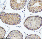 Immunohistochemical staining of DIS3 using anti-DIS3 antibody. DIS3 was detected in a paraffin-embedded section of rat testis tissue. Heat mediated antigen retrieval was performed in EDTA buffer (pH 8.0, epitope retrieval solution). The tissue section was blocked with 10% goat serum. The tissue section was then incubated with 2 ug/ml rabbit anti-DIS3 antibody overnight at 4oC. Peroxidase Conjugated Goat Anti-rabbit IgG was used as secondary antibody and incubated for 30 minutes at 37oC. The tissue section was developed using an HRP secondary and DAB substrate.