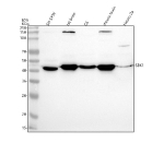 Western blot analysis of SBK1 using anti-SBK1 antibody. Lane 1: human SH-SY5Y whole cell lysates, Lane 2: rat brain tissue lysates, Lane 3: rat C6 whole cell lysates, Lane 4: mouse brain tissue lysates, Lane 5: mouse Neuro-2a whole cell lysates. After electrophoresis, proteins were transferred to a nitrocellulose membrane at 150 mA for 50-90 minutes. Blocked the membrane with 5% non-fat milk/TBS for 1.5 hour at RT. The membrane was incubated with rabbit anti-SBK1 antibody at 0.5 ug/ml overnight at 4oC, then washed with TBS-0.1%Tween 3 times with 5 minutes each and probed with a goat anti-rabbit IgG-HRP secondary antibody at a dilution of 1:5000 for 1.5 hour at RT. The signal was developed using enhanced chemiluminescent. The expected molecular weight of SBK1 is ~46 kDa.