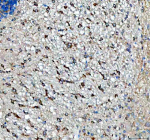 Immunohistochemical staining of SBK1 using anti-SBK1 antibody. SBK1 was detected in a paraffin-embedded section of mouse cerebellum tissue. Heat mediated antigen retrieval was performed in EDTA buffer (pH 8.0, epitope retrieval solution). The tissue section was blocked with 10% goat serum. The tissue section was then incubated with 2 ug/ml rabbit anti-SBK1 antibody overnight at 4oC. Peroxidase Conjugated Goat Anti-rabbit IgG was used as secondary antibody and incubated for 30 minutes at 37oC. The tissue section was developed using an HRP secondary and DAB substrate.