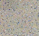 Immunohistochemical staining of SBK1 using anti-SBK1 antibody. SBK1 was detected in a paraffin-embedded section of rat cerebellum tissue. Heat mediated antigen retrieval was performed in EDTA buffer (pH 8.0, epitope retrieval solution). The tissue section was blocked with 10% goat serum. The tissue section was then incubated with 2 ug/ml rabbit anti-SBK1 antibody overnight at 4oC. Peroxidase Conjugated Goat Anti-rabbit IgG was used as secondary antibody and incubated for 30 minutes at 37oC. The tissue section was developed using an HRP secondary and DAB substrate.