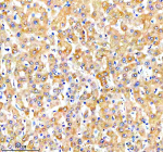 Immunohistochemical staining of NUDT7 using anti-NUDT7 antibody. NUDT7 was detected in a paraffin-embedded section of human liver tissue. Heat mediated antigen retrieval was performed in EDTA buffer (pH 8.0, epitope retrieval solution). The tissue section was blocked with 10% goat serum. The tissue section was then incubated with 2 ug/ml rabbit anti-NUDT7 antibody overnight at 4oC. Peroxidase Conjugated Goat Anti-rabbit IgG was used as secondary antibody and incubated for 30 minutes at 37oC. The tissue section was developed using an HRP secondary and DAB substrate.