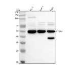 Western blot analysis of HTRA4 using anti-HTRA4 antibody. Lane 1: human PC-3 whole cell lysates, Lane 2: human THP-1 whole cell lysates, Lane 3: human Hela whole cell lysates. After electrophoresis, proteins were transferred to a nitrocellulose membrane at 150 mA for 50-90 minutes. Blocked the membrane with 5% non-fat milk/TBS for 1.5 hour at RT. The membrane was incubated with rabbit anti-HTRA4 antibody at 0.5 ug/ml overnight at 4oC, then washed with TBS-0.1%Tween 3 times with 5 minutes each and probed with a goat anti-rabbit IgG-HRP secondary antibody at a dilution of 1:5000 for 1.5 hour at RT. The signal was developed using enhanced chemiluminescent. The expected molecular weight of HTRA4 is ~51 kDa.
