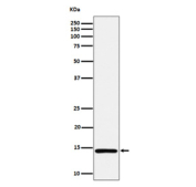 Western blot analysis of Histone H2A (mono methyl K118) expression in human HeLa cell lysate using Histone H2A (mono methyl K118) antibody. Predicted molecular weight ~15 kDa.
