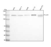 Western blot analysis of ULK1 using anti-Phospho-ULK1 (pSer556) antibody. Lane 1: human 293T whole cell lysates, Lane 2: human MCF-7 whole cell lysates, Lane 3: human whole cell lysates, Lane 4: rat PC-12 whole cell lysates, Lane 5: mouse NIH/3T3 whole cell lysates. After electrophoresis, proteins were transferred to a nitrocellulose membrane at 150 mA for 50-90 minutes. Blocked the membrane with 5% non-fat milk/TBS for 1.5 hour at RT. The membrane was incubated with rabbit anti-Phospho-ULK1 (Ser556) antibody at 1:500 overnight at 4oC, then washed with TBS-0.1%Tween 3 times with 5 minutes each and probed with a goat anti-rabbit IgG-HRP secondary antibody at a dilution of 1:5000 for 1.5 hour at RT. The signal was developed using enhanced chemiluminescent. Western blot detection of phospho-ULK1 (Ser556) shows a band at ~150 kDa across multiple cell lines. Although the predicted molecular weight of ULK1 is ~113 kDa, the phosphorylated form commonly migrates higher due to multiple phosphorylation events and other post-translational modifications.