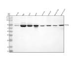 Western blot analysis of RTKN2 using anti-RTKN2 antibody. Lane 1: human HL-60 whole cell lysates, Lane 2: human Raji whole cell lysates, Lane 3: human 293T whole cell lysates, Lane 4: human whole cell lysates, Lane 5: rat lung tissue lysates, Lane 6: rat brain tissue lysates, Lane 7: mouse lung tissue lysates, Lane 8: mouse brain tissue lysates. After electrophoresis, proteins were transferred to a nitrocellulose membrane at 150 mA for 50-90 minutes. Blocked the membrane with 5% non-fat milk/TBS for 1.5 hour at RT. The membrane was incubated with rabbit anti-RTKN2 antibody at 0.25 ug/ml overnight at 4oC, then washed with TBS-0.1%Tween 3 times with 5 minutes each and probed with a goat anti-rabbit IgG-HRP secondary antibody at a dilution of 1:5000 for 1.5 hour at RT. The signal was developed using enhanced chemiluminescent. A specific band was detected for RTKN2 at approximately 69 kDa. The expected molecular weight of RTKN2 is ~69 kDa.