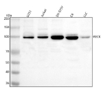 Western blot analysis of RECK using anti-RECK antibody. Lane 1: human U251 whole cell lysates, Lane 2: human Jurkat whole cell lysates, Lane 3: human SH-SY5Y whole cell lysates, Lane 4: rat C6 whole cell lysates, Lane 5: mouse LLC whole cell lysates. After electrophoresis, proteins were transferred to a nitrocellulose membrane at 150 mA for 50-90 minutes. Blocked the membrane with 5% non-fat milk/TBS for 1.5 hour at RT. The membrane was incubated with rabbit anti-RECK antibody at 0.5 ug/ml overnight at 4oC, then washed with TBS-0.1%Tween 3 times with 5 minutes each and probed with a goat anti-rabbit IgG-HRP secondary antibody at a dilution of 1:5000 for 1.5 hour at RT. The signal was developed using enhanced chemiluminescent. Western blot detection of RECK shows a single band migrating just below 100 kDa across multiple lysates. Although the calculated mass is ~106 kDa, RECK frequently runs between ~95 and 115 kDa due to variable glycosylation and maturation of this GPI-anchored protein.