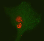 Immunofluorescent staining of PAX3 using anti-PAX3 antibody (red) and anti-Beta Tubulin antibody (green). PAX3 was detected in immunocytochemical section of cell. Enzyme antigen retrieval was performed using IHC enzyme antigen retrieval reagent for 15 mins. The cells were blocked with 10% goat serum. And then incubated with 5 ug/ml rabbit anti-PAX3 antibody and mouse anti-Beta Tubulin antibody overnight at 4oC. Cy3 Conjugated Goat Anti-Rabbit IgG and DyLight 488 Conjugated Goat Anti-Mouse IgG were used as secondary antibody at 1:500 dilution and incubated for 30 minutes at 37oC. Visualize using a fluorescence microscope and filter sets appropriate for the label used.