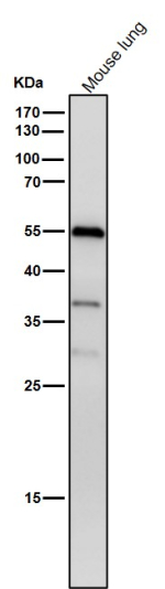 Western blot testing of mouse lung tissue lysate using the Phospho-Beta Arrestin 1 (Ser412) antibody at 1:1000 dilution for 1 hour at room temperature. Western blot analysis of phospho-beta-arrestin 1 (Ser412) shows a dominant band at ~55 kDa and a secondary band near ~37 kDa across multiple cell lines. Although the predicted size of beta-arrestin 1 is ~47 kDa, phosphorylation at Ser412 causes an upward mobility shift, while the lower band likely represents a truncated or partially degraded form of the protein.