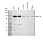 Western blot analysis of DNMT3A using anti-DNMT3A antibody. Electrophoresis was performed on a 10% SDS-PAGE gel at 80V (Stacking gel) / 120V (Resolving gel) for 2 hours. Lane 1: human 293T whole cell lysates, Lane 2: human MCF-7 whole cell lysates, Lane 3: rat testis tissue lysates, Lane 4: mouse testis tissue lysates, Lane 5: mouse NIH/3T3 whole cell lysates. After electrophoresis, proteins were transferred to a nitrocellulose membrane at 150 mA for 50-90 minutes. Blocked the membrane with 5% non-fat milk/TBS for 1.5 hour at RT. The membrane was incubated with rabbit anti-DNMT3A antibody at 0.5 ug/ml overnight at 4oC, then washed with TBS-0.1%Tween 3 times with 5 minutes each and probed with a goat anti-rabbit IgG-HRP secondary antibody at a dilution of 1:5000 for 1.5 hour at RT. The signal was developed using an ECL Plus Western Blotting Substrate. Western blot detection of DNMT3A shows a predominant band at ~120-130 kDa across cell lines, consistent with the DNMT3A1 isoform. The shorter DNMT3A2 isoform (~102 kDa) is not prominent in these samples. Post-translational modifications may further increase apparent molecular weight.