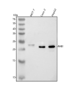 Western blot analysis of RAB1A using anti-RAB1A antibody. Lane 1: human MCF-7 whole cell lysates, Lane 2: human Caco-2 whole cell lysates, Lane 3: human HepG2 whole cell lysates. After electrophoresis, proteins were transferred to a nitrocellulose membrane at 150 mA for 50-90 minutes. Blocked the membrane with 5% non-fat milk/TBS for 1.5 hour at RT. The membrane was incubated with rabbit anti-RAB1A antibody at 0.5 ug/ml overnight at 4oC, then washed with TBS-0.1%Tween 3 times with 5 minutes each and probed with a goat anti-rabbit IgG-HRP secondary antibody at a dilution of 1:5000 for 1.5 hour at RT. The signal was developed using enhanced chemiluminescent. RAB1A is detected at ~22-23 kDa across lines; in MCF7 the band migrates slightly higher, consistent with cell-typeâdependent prenylation/phosphorylation and membrane association that modestly slow SDS-PAGE mobility.
