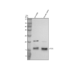 Western blot analysis of IFT20 using anti-IFT20 antibody. Electrophoresis was performed on a 12% SDS-PAGE gel at 80V (Stacking gel) / 120V (Resolving gel) for 2 hours. Lane 1: rat testis tissue lysates, Lane 2: mouse testis tissue lysates. After electrophoresis, proteins were transferred to a nitrocellulose membrane at 150 mA for 50-90 minutes. Blocked the membrane with 5% non-fat milk/TBS for 1.5 hour at RT. The membrane was incubated with rabbit anti-IFT20 antibody at 0.5 ug/ml overnight at 4oC, then washed with TBS-0.1%Tween 3 times with 5 minutes each and probed with a goat anti-rabbit IgG-HRP secondary antibody at a dilution of 1:5000 for 1.5 hour at RT. The signal was developed using an ECL Plus Western Blotting Substrate. Western blot detection of IFT20 shows a major band at ~15 kDa and a weaker band near ~20 kDa in rat and mouse testis lysates. The higher-migrating species likely represents a post-translationally modified or extended isoform of IFT20, which has been reported in ciliated and testicular tissues.