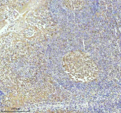Immunohistochemical staining of Caspase 3 using anti-CASP3 antibody. Caspase 3 was detected in a paraffin-embedded section of human tonsil tissue. Heat mediated antigen retrieval was performed in EDTA buffer (pH 8.0, epitope retrieval solution). The tissue section was blocked with 10% goat serum. The tissue section was then incubated with 1:50 rabbit anti-CASP3 antibody overnight at 4oC. Peroxidase Conjugated Goat Anti-rabbit IgG was used as secondary antibody and incubated for 30 minutes at 37oC. The tissue section was developed using an HRP secondary and DAB substrate.
