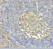 Immunohistochemical staining of Caspase 3 using anti-CASP3 antibody. Caspase 3 was detected in a paraffin-embedded section of human tonsil tissue. Heat mediated antigen retrieval was performed in EDTA buffer (pH 8.0, epitope retrieval solution). The tissue section was blocked with 10% goat serum. The tissue section was then incubated with 1:50 rabbit anti-CASP3 antibody overnight at 4oC. Peroxidase Conjugated Goat Anti-rabbit IgG was used as secondary antibody and incubated for 30 minutes at 37oC. The tissue section was developed using an HRP secondary and DAB substrate.