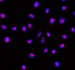 Immunofluorescent staining of RSL24D1 using anti-RSL24D1 antibody (red). RSL24D1 was detected in an immunocytochemical section of cells. Enzyme antigen retrieval was performed using IHC enzyme antigen retrieval reagent for 15 mins. The cells were blocked with 10% goat serum. And then incubated with 5 ug/ml rabbit anti-RSL24D1 antibody overnight at 4oC. Cy3 Conjugated Goat Anti-Rabbit IgG was used as secondary antibody at 1:500 dilution and incubated for 30 minutes at 37oC. The section was counterstained with DAPI nuclear stain (blue). Visualize using a fluorescence microscope and filter sets appropriate for the label used.