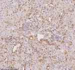 Immunohistochemical staining of PTRHD1 using anti-PTRHD1 antibody. PTRHD1 was detected in a paraffin-embedded section of mouse kidney tissue. Heat mediated antigen retrieval was performed in EDTA buffer (pH 8.0, epitope retrieval solution). The tissue section was blocked with 10% goat serum. The tissue section was then incubated with 2 ug/ml rabbit anti-PTRHD1 antibody overnight at 4oC. Peroxidase Conjugated Goat Anti-rabbit IgG was used as secondary antibody and incubated for 30 minutes at 37oC. The tissue section was developed using an HRP secondary and DAB substrate.