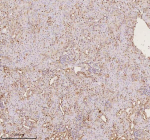 Immunohistochemical staining of PTRHD1 using anti-PTRHD1 antibody. PTRHD1 was detected in a paraffin-embedded section of mouse kidney tissue. Heat mediated antigen retrieval was performed in EDTA buffer (pH 8.0, epitope retrieval solution). The tissue section was blocked with 10% goat serum. The tissue section was then incubated with 2 ug/ml rabbit anti-PTRHD1 antibody overnight at 4oC. Peroxidase Conjugated Goat Anti-rabbit IgG was used as secondary antibody and incubated for 30 minutes at 37oC. The tissue section was developed using an HRP secondary and DAB substrate.