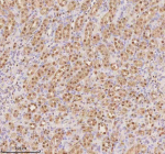 Immunohistochemical staining of PTRHD1 using anti-PTRHD1 antibody. PTRHD1 was detected in a paraffin-embedded section of rat kidney tissue. Heat mediated antigen retrieval was performed in EDTA buffer (pH 8.0, epitope retrieval solution). The tissue section was blocked with 10% goat serum. The tissue section was then incubated with 2 ug/ml rabbit anti-PTRHD1 antibody overnight at 4oC. Peroxidase Conjugated Goat Anti-rabbit IgG was used as secondary antibody and incubated for 30 minutes at 37oC. The tissue section was developed using an HRP secondary and DAB substrate.