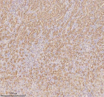 Immunohistochemical staining of PTRHD1 using anti-PTRHD1 antibody. PTRHD1 was detected in a paraffin-embedded section of rat kidney tissue. Heat mediated antigen retrieval was performed in EDTA buffer (pH 8.0, epitope retrieval solution). The tissue section was blocked with 10% goat serum. The tissue section was then incubated with 2 ug/ml rabbit anti-PTRHD1 antibody overnight at 4oC. Peroxidase Conjugated Goat Anti-rabbit IgG was used as secondary antibody and incubated for 30 minutes at 37oC. The tissue section was developed using an HRP secondary and DAB substrate.